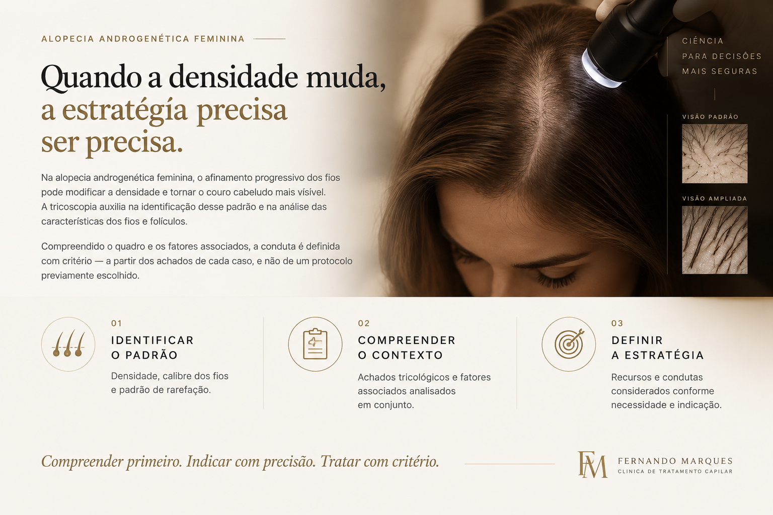 Alopecia androgenética feminina